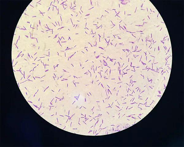 猪性大肠秆菌种类及其影响