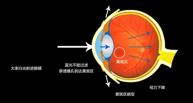 如何检验防蓝光眼镜的真假——深入了解防蓝光眼镜的鉴别方法