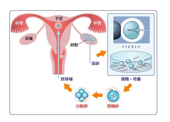排卵正常与取卵过程，深入了解与关怀