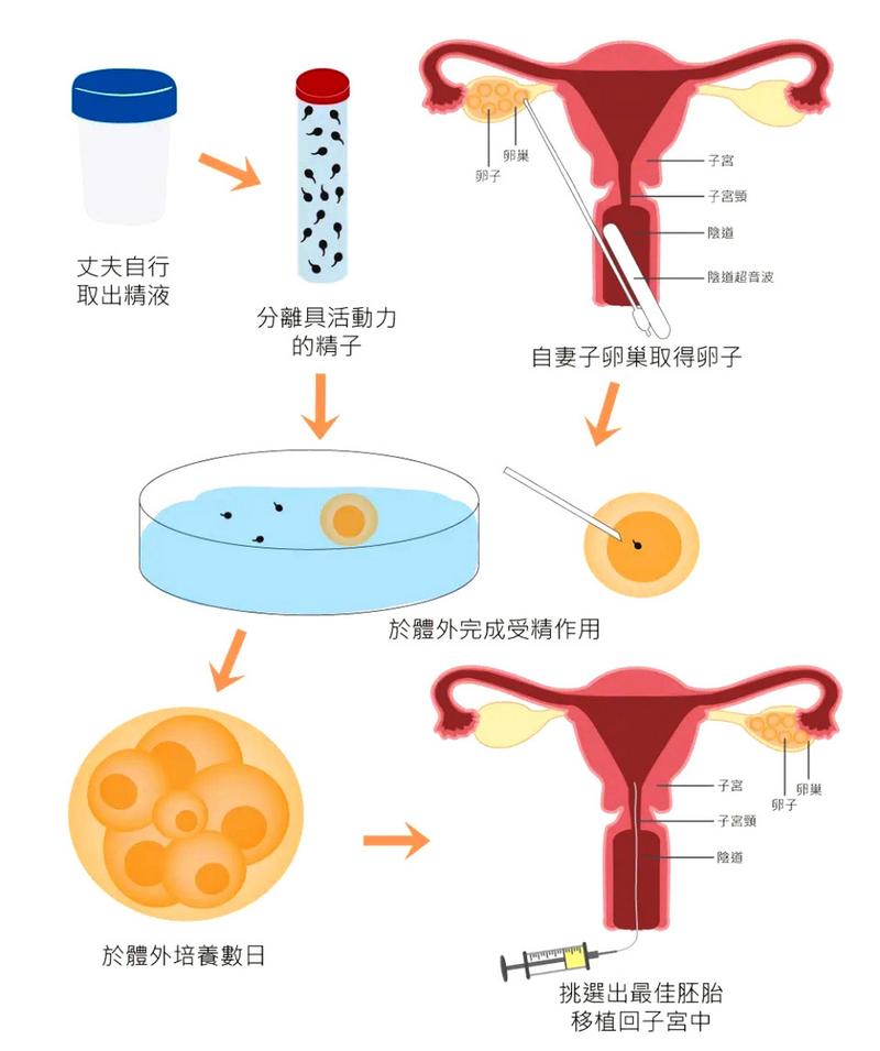 试管取卵配对成功率，探索现代生殖技术的成功率与影响因素