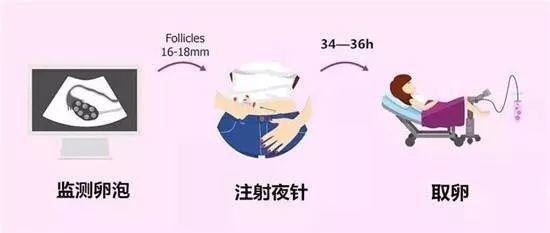 关于降调针打多久取卵的探讨