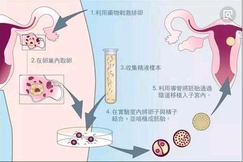 取卵后几天内膜变化的观察与研究
